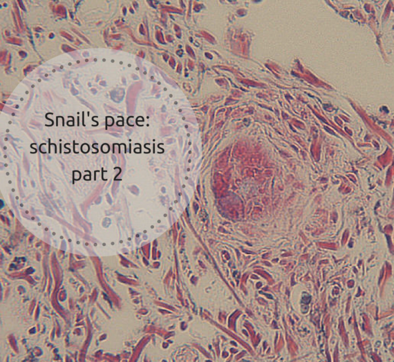 Snail’s pace: schistosomiasis part 2