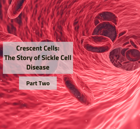 Crescent Cells: The Story of Sickle Cell Disease (Part Two)